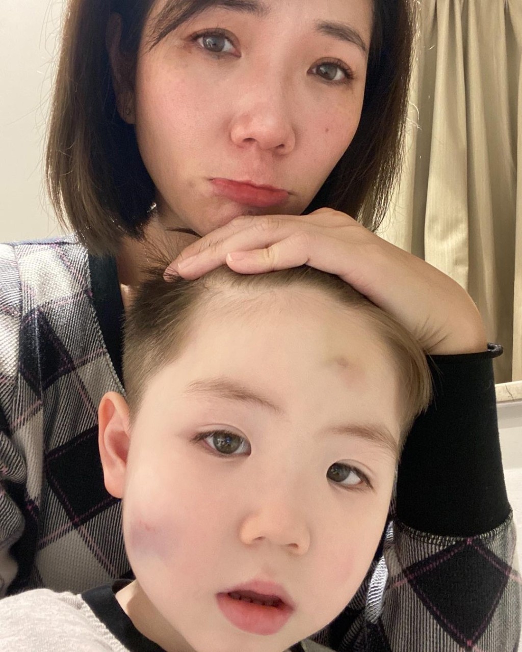 婉婉上月都晒過BBQ玩到成面瘀傷的照片。