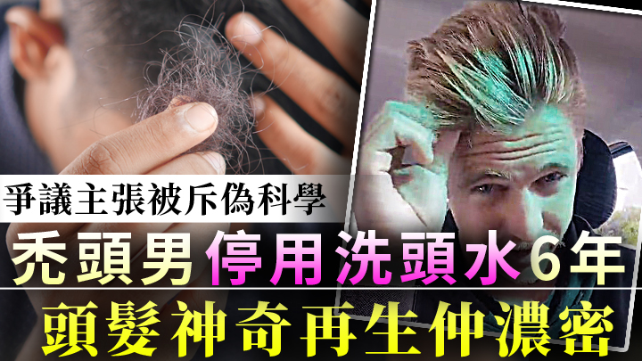 Nick聲稱靠只用清水洗頭令頭髮再生,掀起爭議。(影片截圖及unsplash設計圖片)