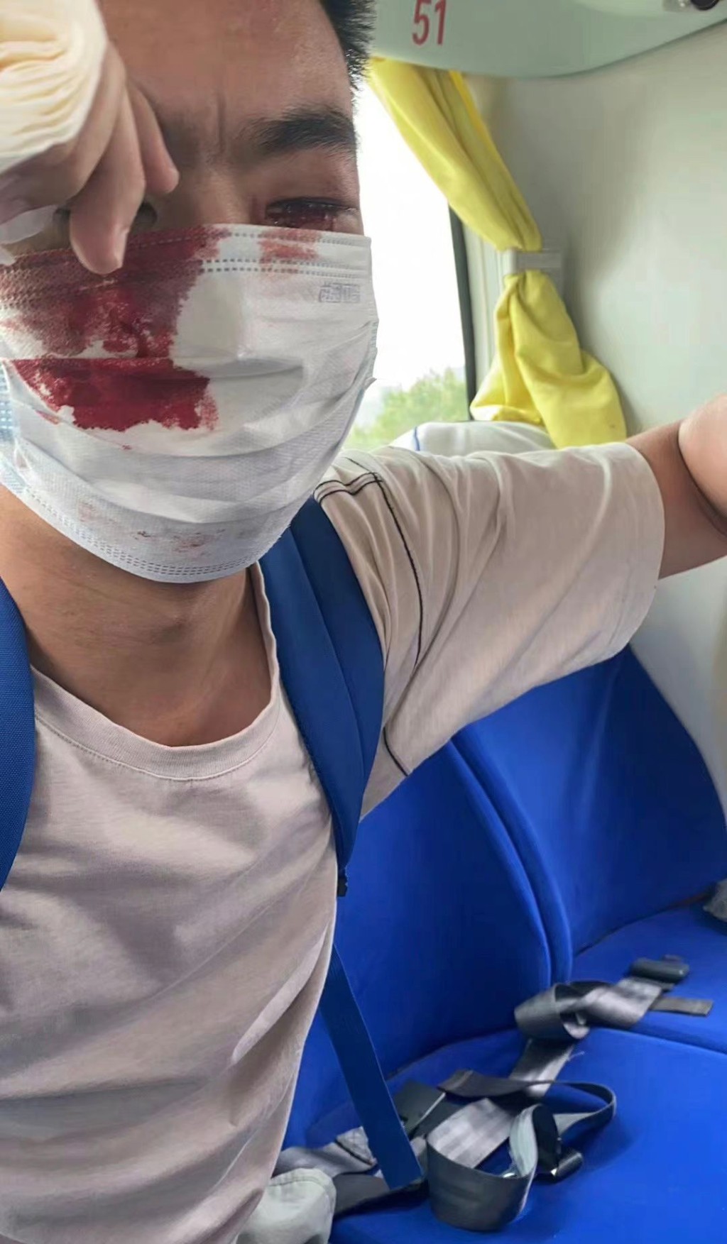 有人眼睛红肿受伤流血。网图