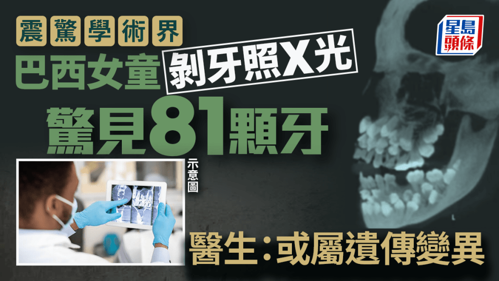 Alamy示意圖 /《美國正畸與牙面骨科雜誌》