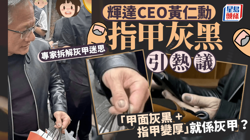 輝達CEO黃仁勳指甲灰黑引熱議 專家拆解灰甲迷思 雨天護足4招防感染