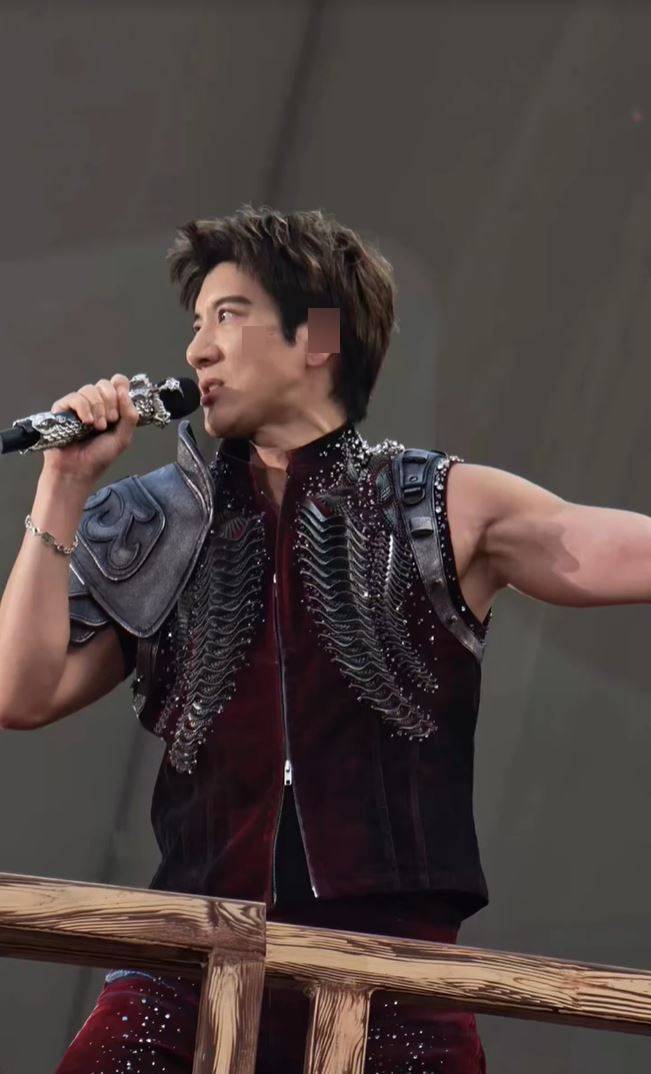 王力宏被「威吔」絆倒致左耳及臉部共縫39針。小紅書 王力宏被「威吔」絆倒致左耳及臉部共縫39針。小紅書