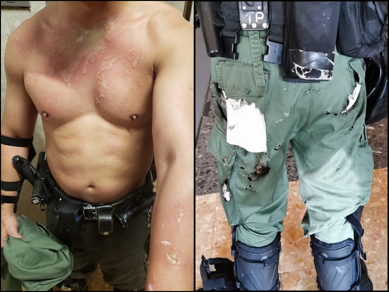 有警員遭淋潑腐蝕性液體。警方圖片