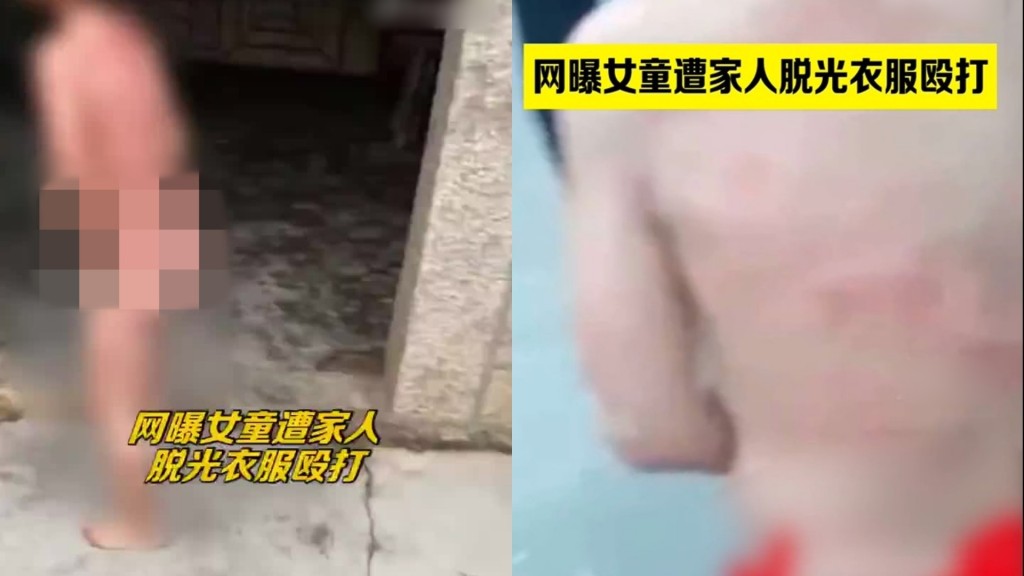 女童被脫光衣服滿身傷痕。網圖
