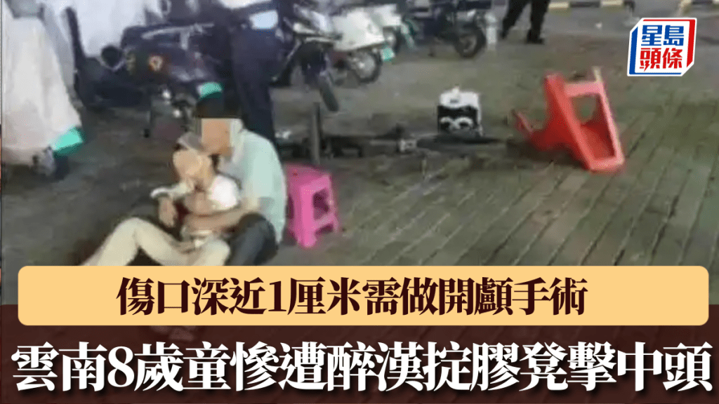 雲南8歲童慘遭醉漢膠凳砸頭，傷口深近1厘米需做開顱手術。