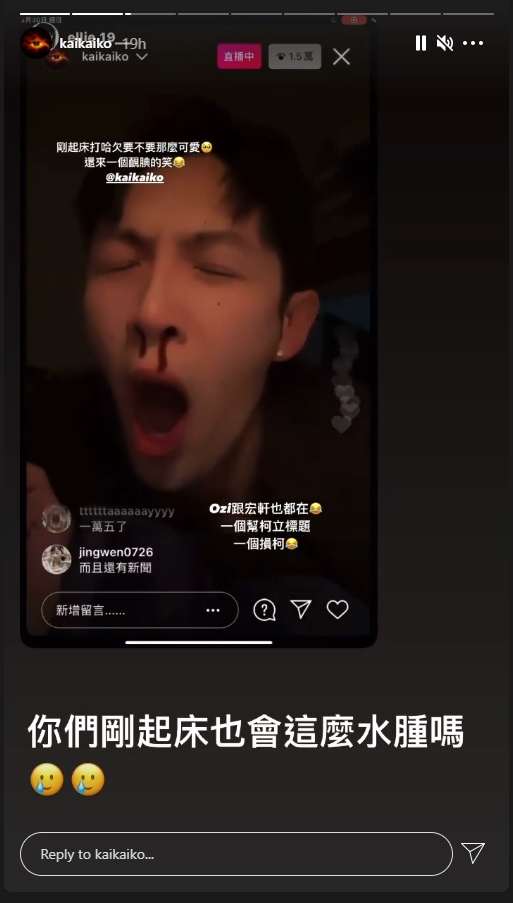事後柯震東上載IG Story話自己瞓醒之後面都腫埋。