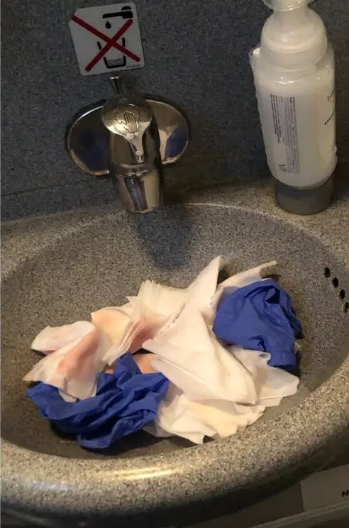 客机上洗手间，留下用过湿纸巾的血迹。