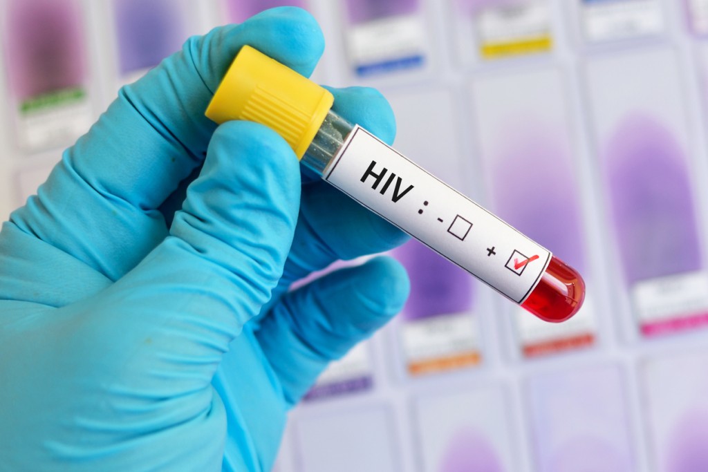 新增的93宗感染愛滋病病毒個案，3人透過注射毒品受感染。iStock圖片