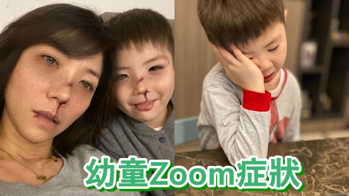 車婉婉指兒子有齊幼童Zoom症狀。