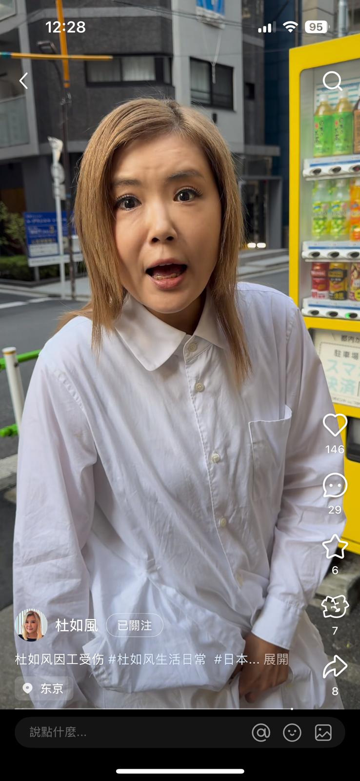 眼袋浮腫。 眼袋浮腫。