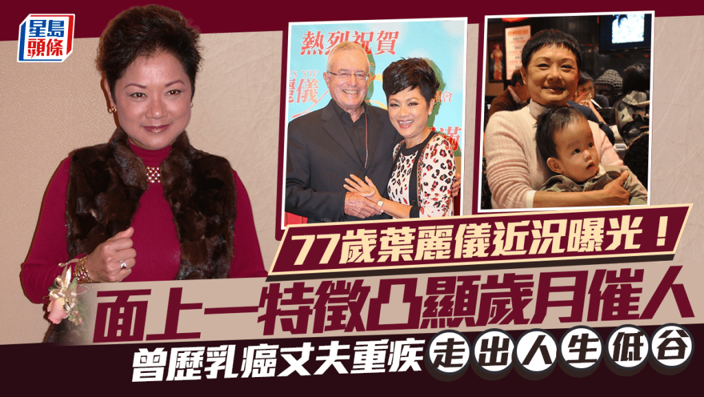 77歲葉麗儀近況曝光！面上一特徵凸顯歲月催人  曾歷乳癌丈夫重疾走出人生低谷