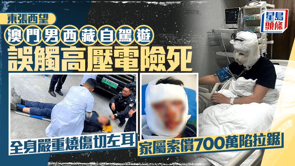 东张西望丨澳门男西藏自驾游误触高压电 全身严重烧伤切左耳 家属索偿700万陷拉锯