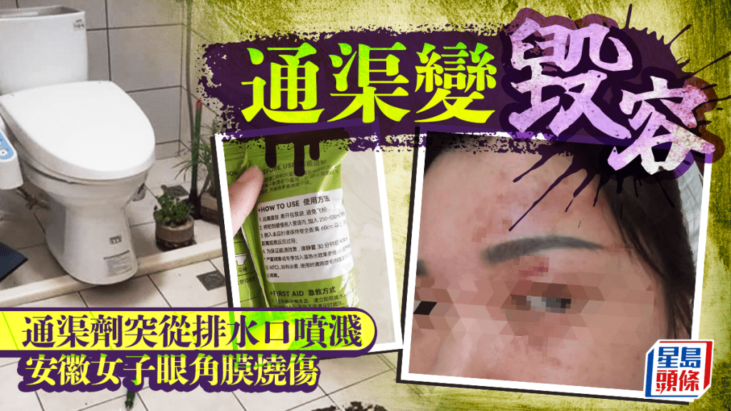 安徽女用疏通劑清理管道，遭噴濺液體燒傷眼角膜。極目新聞