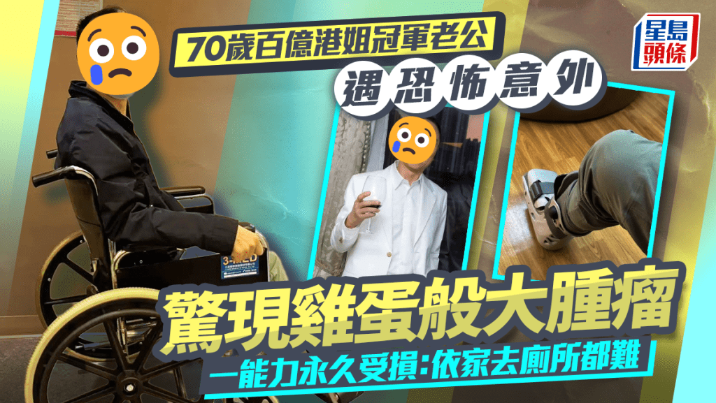 70歲百億港姐冠軍老公遇恐怖意外  發現雞蛋般大腫瘤  一能力永久受損：依家去廁所都難