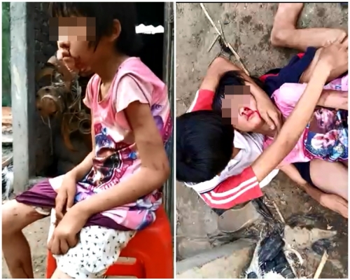 女童重傷,哥哥只能抱著她安慰。網圖
