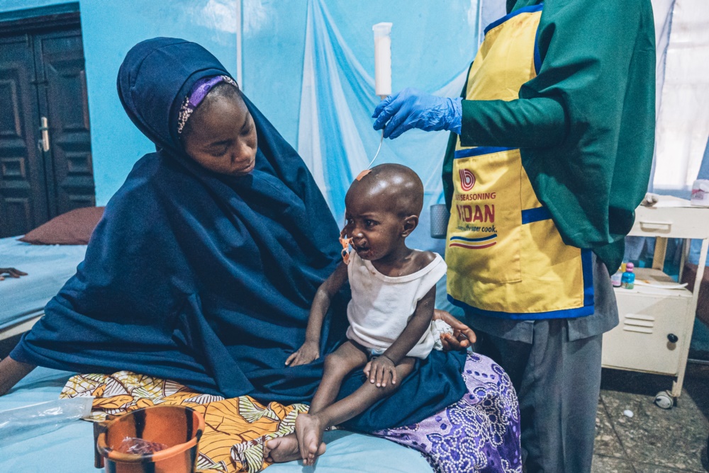 一歲半的尼日利亞男童（中）被確診患上壞疽性口炎，他同時營養不良，無國界醫生團隊爲他提供治療。©無國界醫生