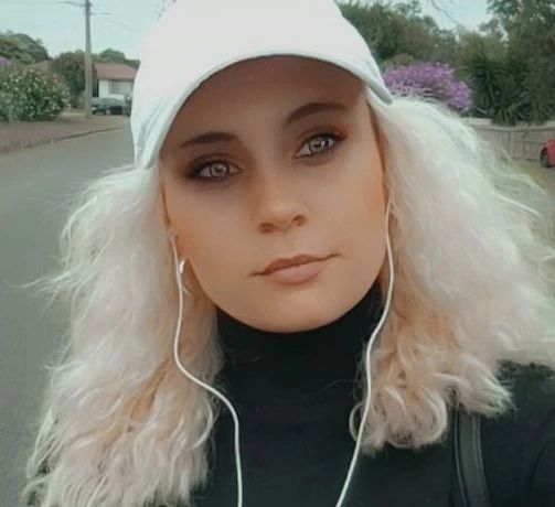 澳洲有29岁女子Ashley Timbery感染超级细菌，2周后因肺炎、败血症等症状逝世。IG