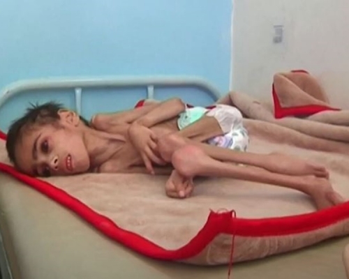 Faid 整個身體的骨架只佔醫院折疊好的毯子的四分之一。Al-Sabeen醫院推特