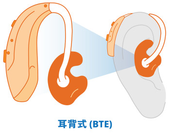 掛在耳朵後面的「耳背式」(BTE) 掛在耳朵後面的「耳背式」(BTE)