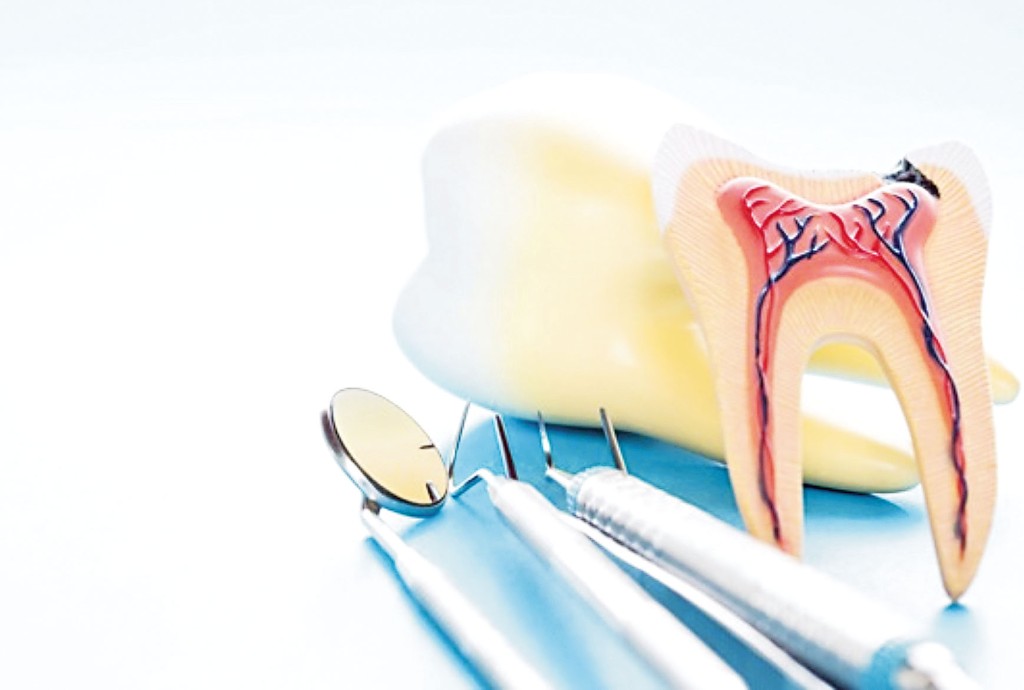 牙髓当中包含血管及神经，一旦受感染会引致牙髓病。