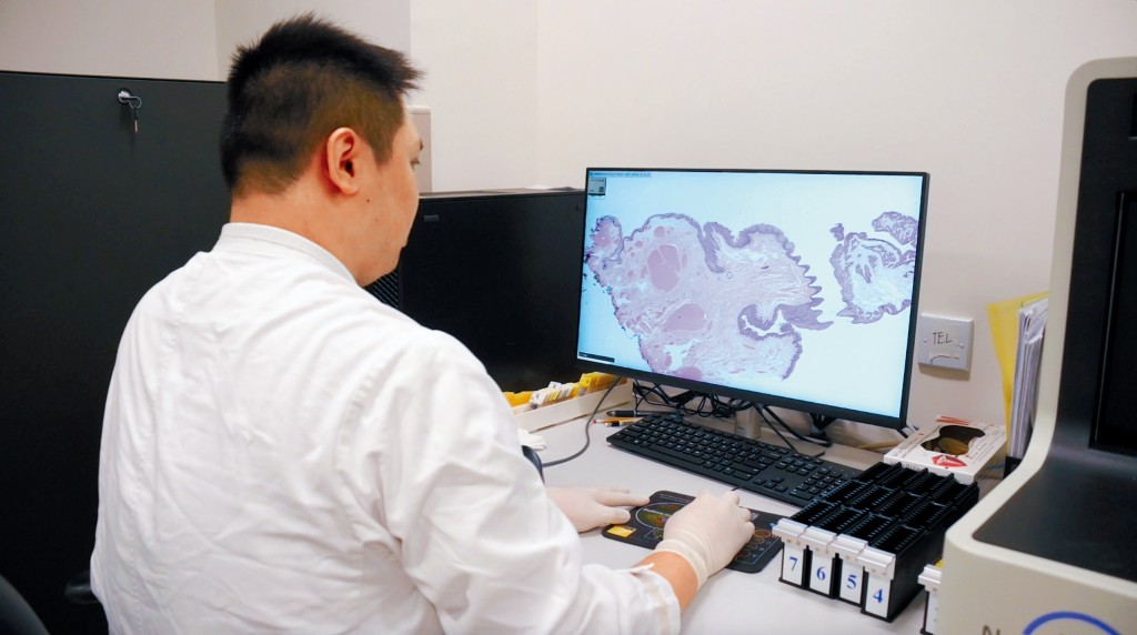 先進的掃描儀器結合人工智能分析,有助加快偵測高風險個案,縮短病人等候時間,更快得到適切治療。 先進的掃描儀器結合人工智能分析,有助加快偵測高風險個案,縮短病人等候時間,更快得到適切治療。