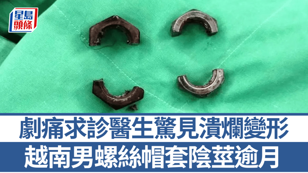 醫護人員用切割器將事主下體的螺絲帽割斷。圖:Znews