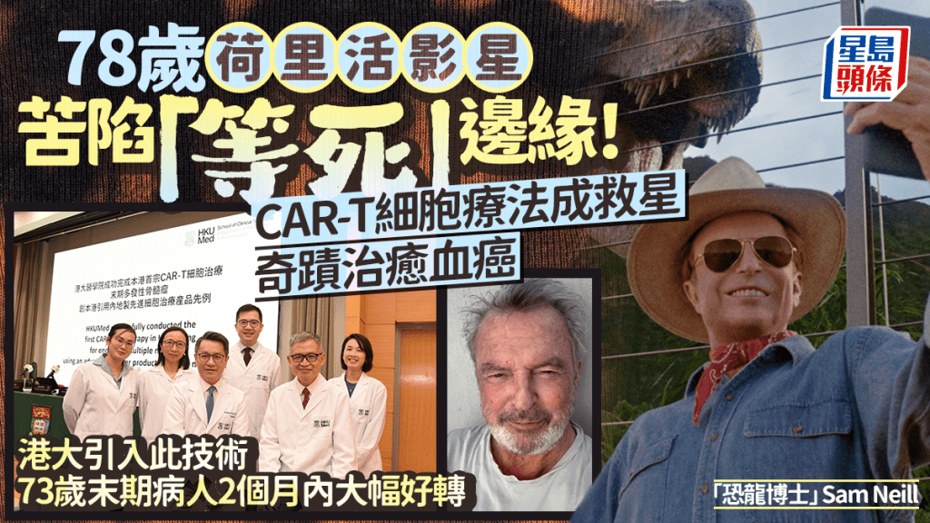 78歲荷里活影星苦陷「等死」邊緣！CAR-T細胞療法成救星 奇蹟治癒血癌 港大引入此技術 73歲末期病人2個月內大幅好轉