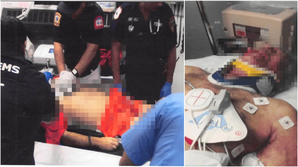 愛潑斯坦自縊後照片首曝光，頸現深色勒痕，喉結骨幾乎斷。 美國司法部