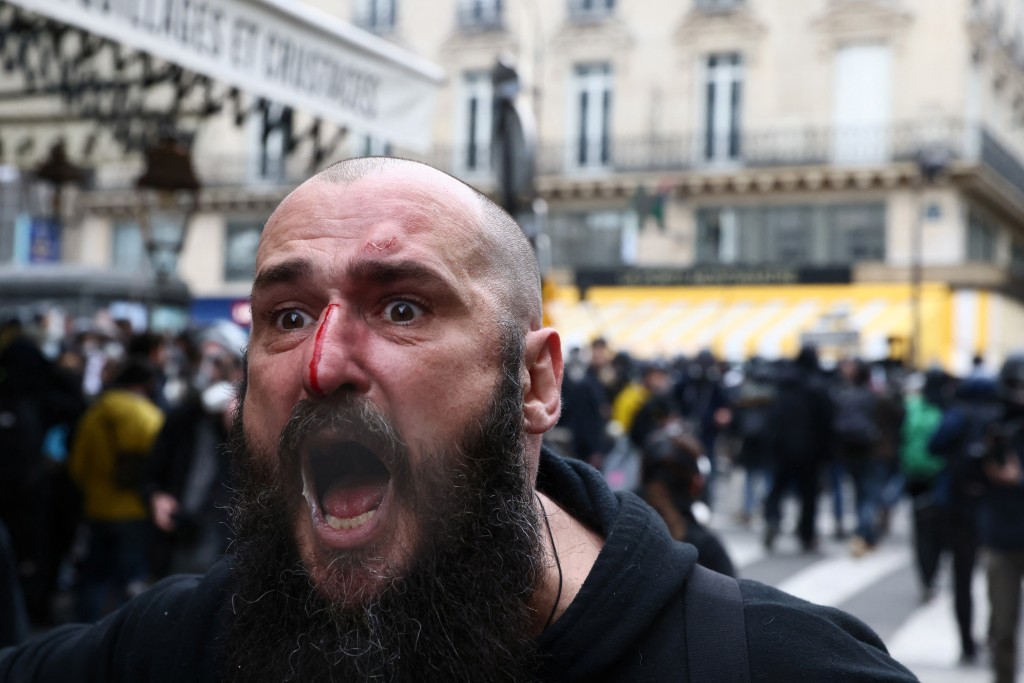 法国退休改革引发的全国示威进入第9天，一名受伤的示威者情绪激动。 路透社