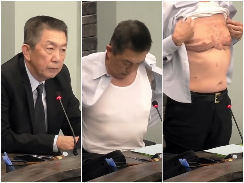 西徹斯特鎮鎮委會華裔理事黃良華早前開會時脫衣展示傷疤，以表達對歧視的不滿。AP圖片