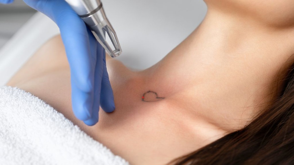 巴西一名牙醫禁錮女友多月，又在對方身上紋上自己的名字，以宣示主權。iStock