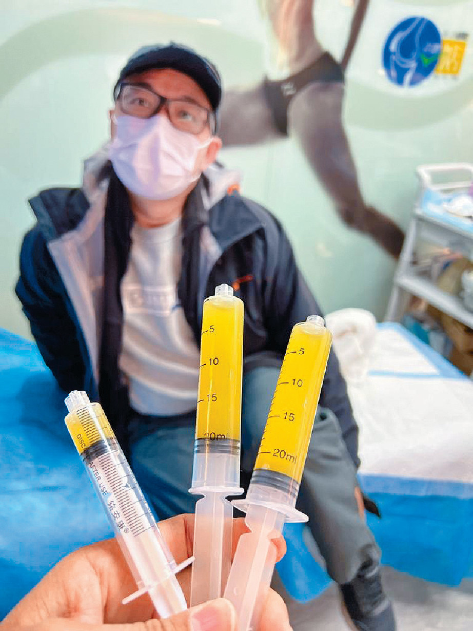 ■梁先生的膝蓋在抽出積水後，已即時減低疼痛感。