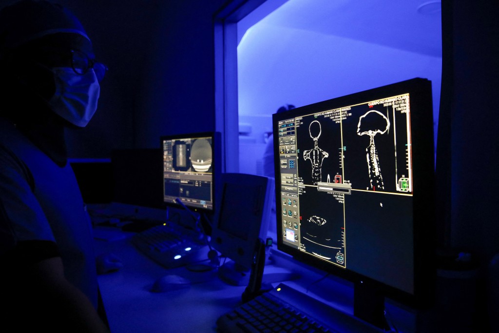 研究人员利用Ｘ光及电脑扫描，检测墨西哥「千年外星人」。（路透社）
