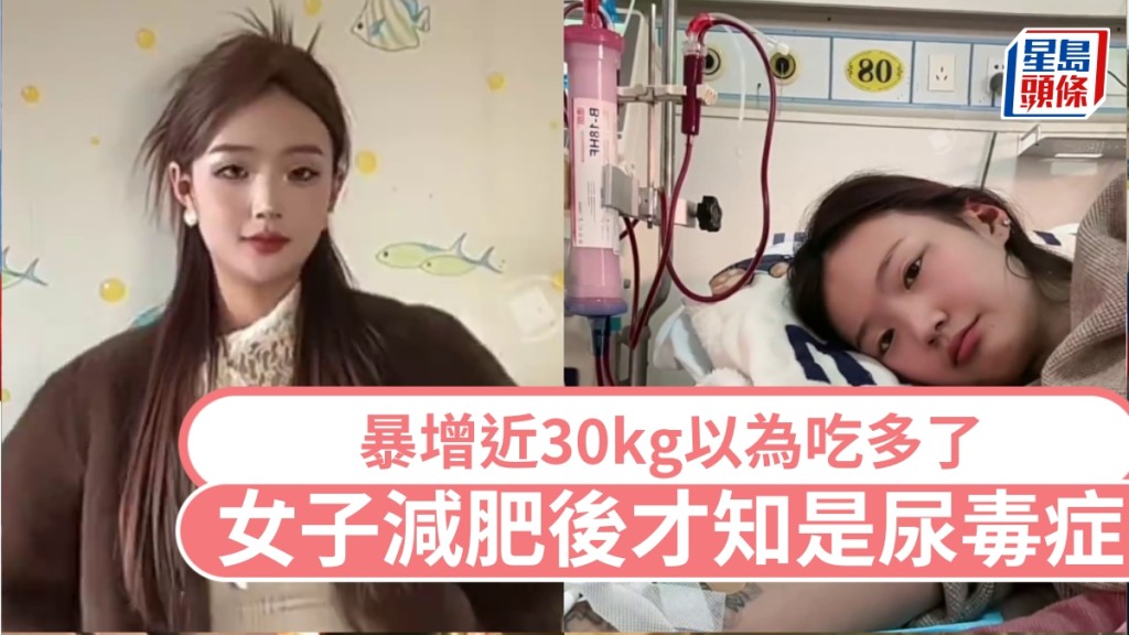 暴增近30kg以為吃多了，女子半年減肥25kg後確診尿毒症。