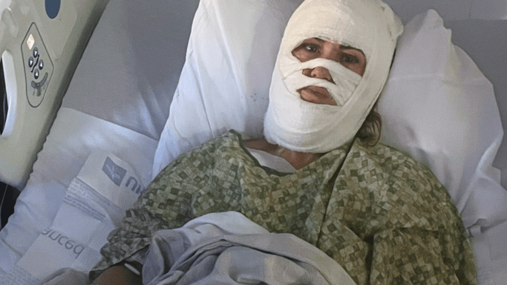 瓦西列夫斯基全身多處燒傷。美聯社