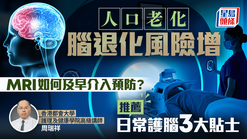 人口老化脑退化风险增 MRI如何及早介入预防？专家推荐日常护脑3大贴士