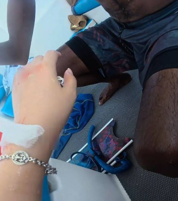 內地女遊客「大姨媽」到仍潛水，疑血腥味刺激鯊魚，導致手部被咬出血洞。抖音＠我愛藍色