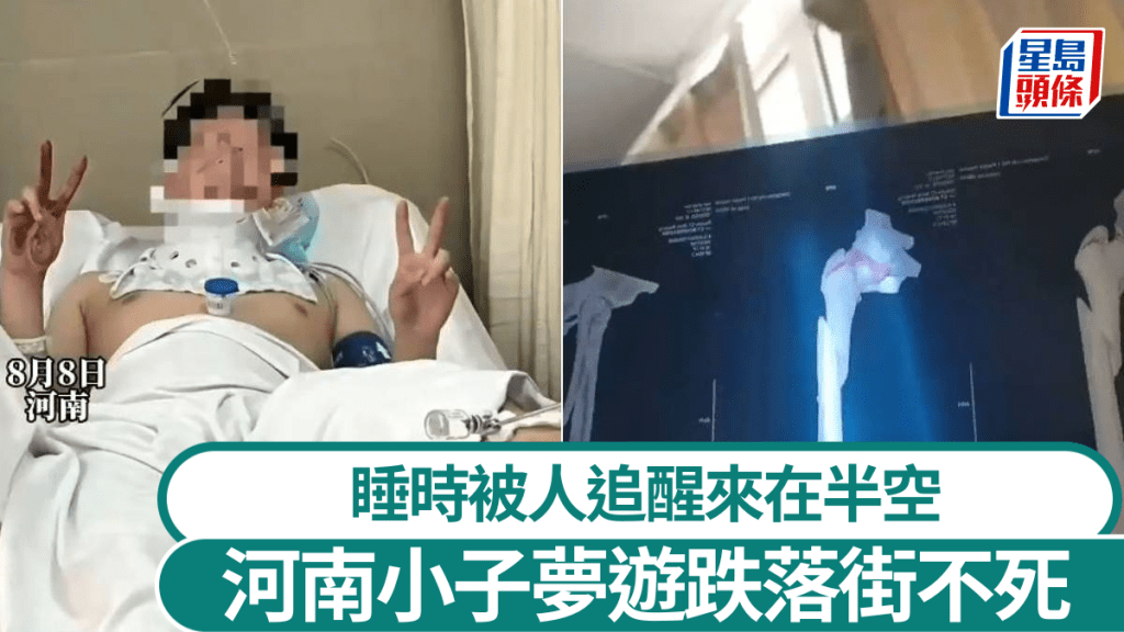 曹先生夢遊從3樓墜下多處骨折。抖音