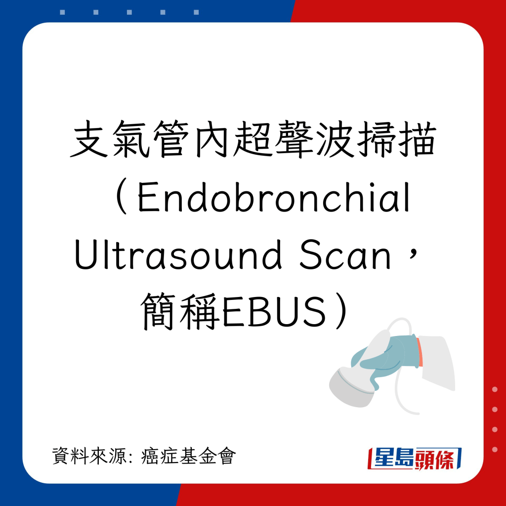 肺癌检查｜跟进检查7大方法：支气管内超声波扫描（Endobronchial Ultrasound Scan，简称EBUS）