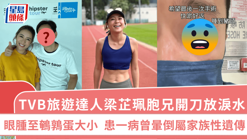 TVB旅遊達人梁芷珮胞兄開刀放淚水  眼腫至鵪鶉蛋大小  患一病曾暈倒屬家族性遺傳