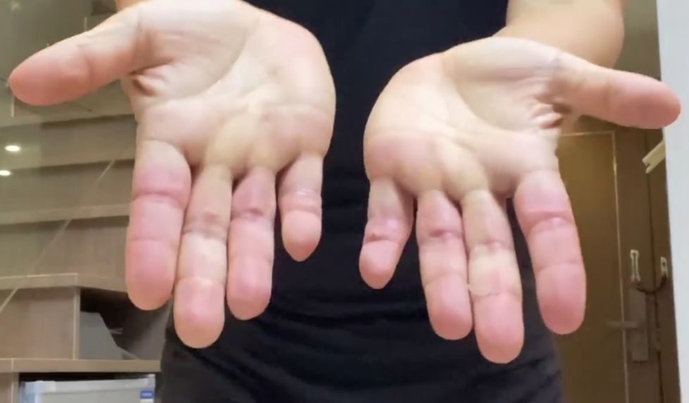 練到雙手都損咗。