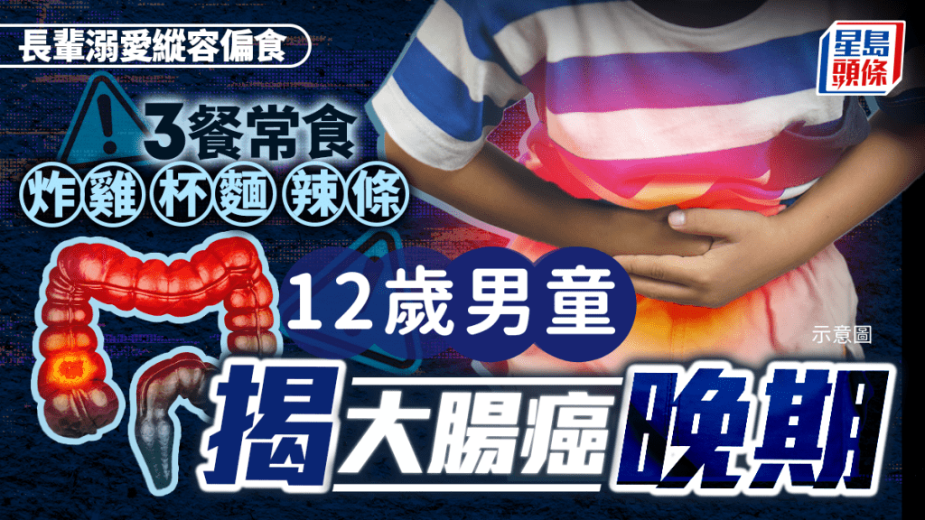 長輩溺愛縱容偏食 3餐常食炸雞杯麵辣條 12歲男童腹痛揭大腸癌晚期