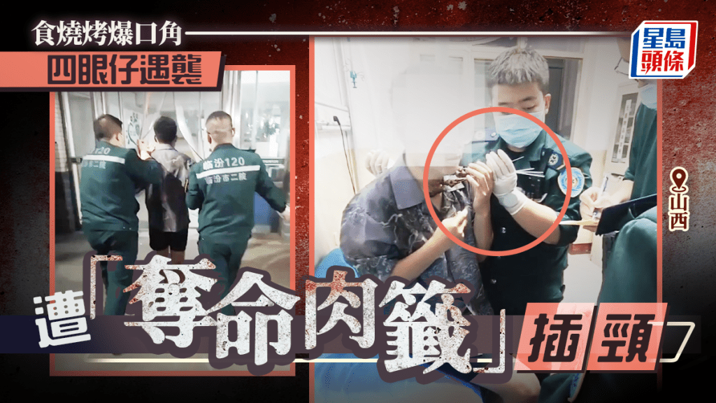 燒烤籤當飛鏢 | 山西男同人嗌交 頸部遭插四串「奪命肉籤」
