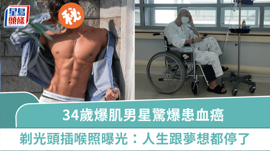 34歲爆肌男星確診血癌  剃光頭插喉照曝光  訴崩潰心情：人生跟夢想都停了