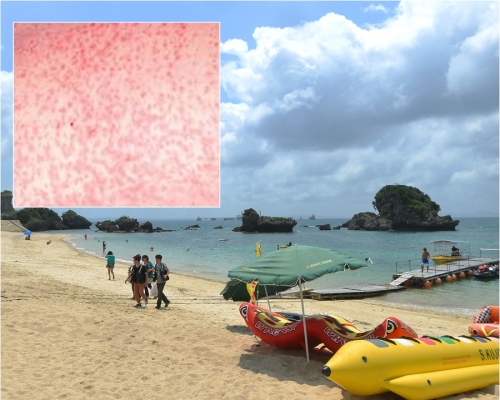 日本沖繩麻疹個案出現上升的情況。資料圖片