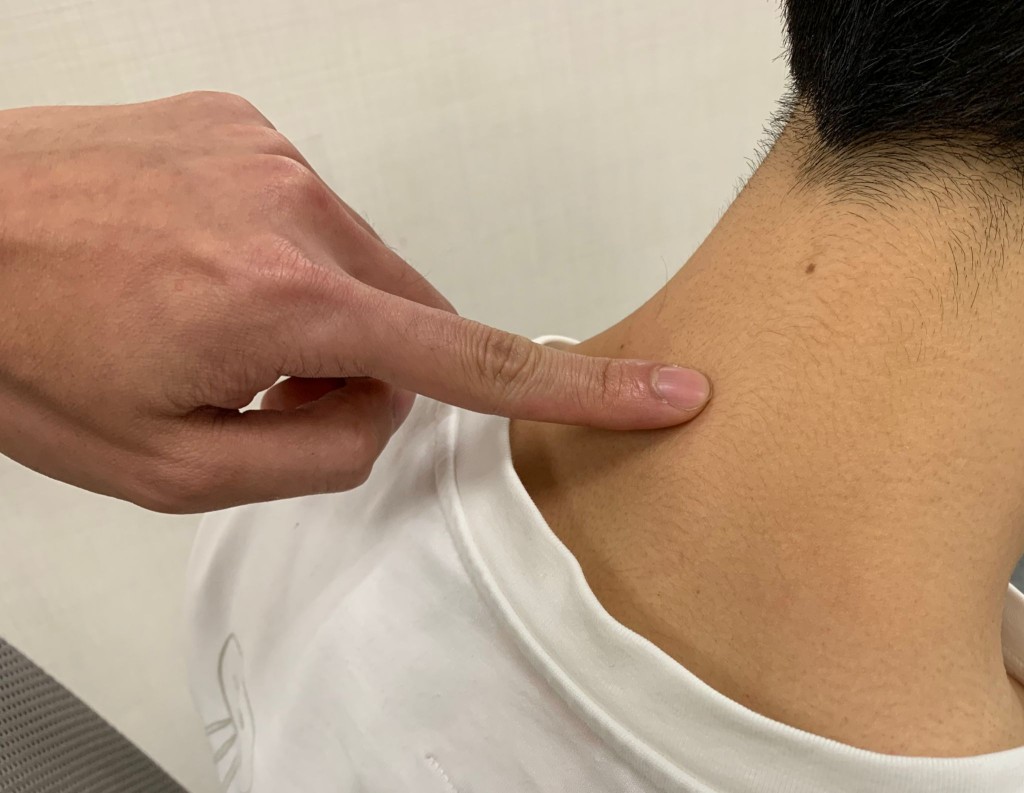 大椎穴位置。 大椎穴位置。