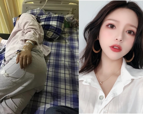 孕婦(左圖)在微博發文控訴因遛狗衝突被內地女網紅Saya(右圖)毆打辱罵的經歷。(網圖)