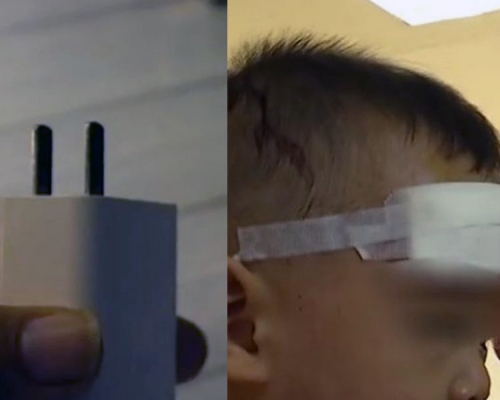 廣西兩歲童睡覺滾下床,手機充電器插入頭部。(網圖)