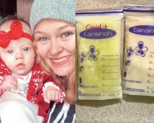 23歲的年輕媽媽染疾後母乳變成螢光綠色。網圖