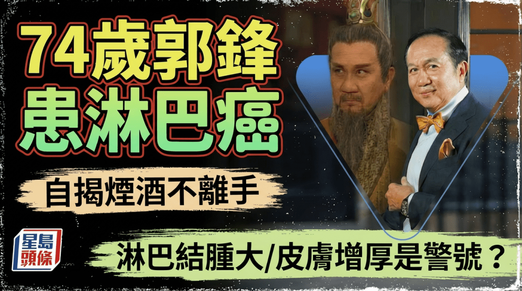 郭鋒患淋巴癌自揭煙酒不離手  淋巴結腫大/皮膚增厚是警號